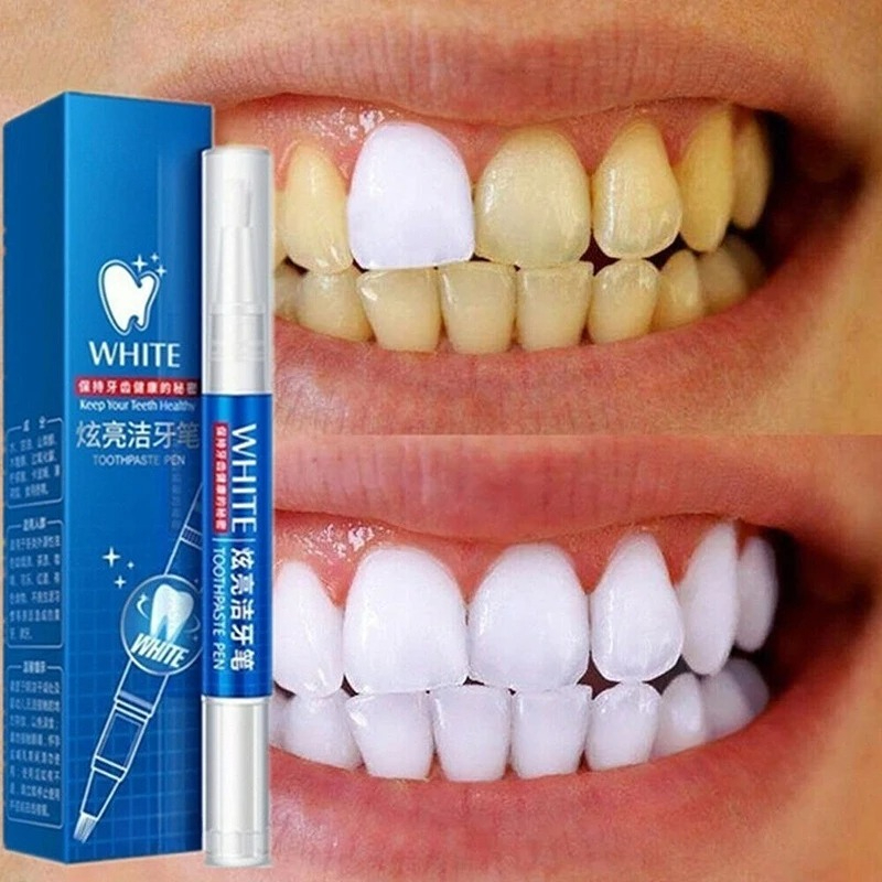 50 ML Teeth Whitening Stain Re - огляд і ціна Teeth Whitening Gel Pen