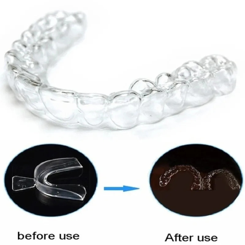 1/3/6pairs Silicone Mouth Guar - огляд і ціна Teeth Whitening With Braces