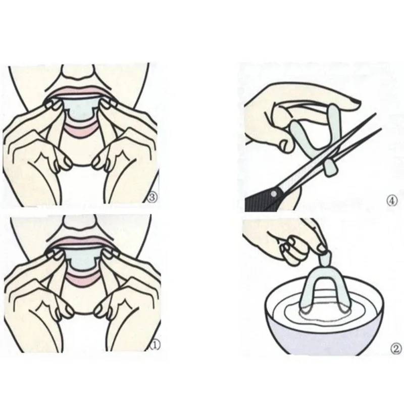 1/3/6pairs Silicone Mouth Guar - огляд і ціна Teeth Whitening With Braces