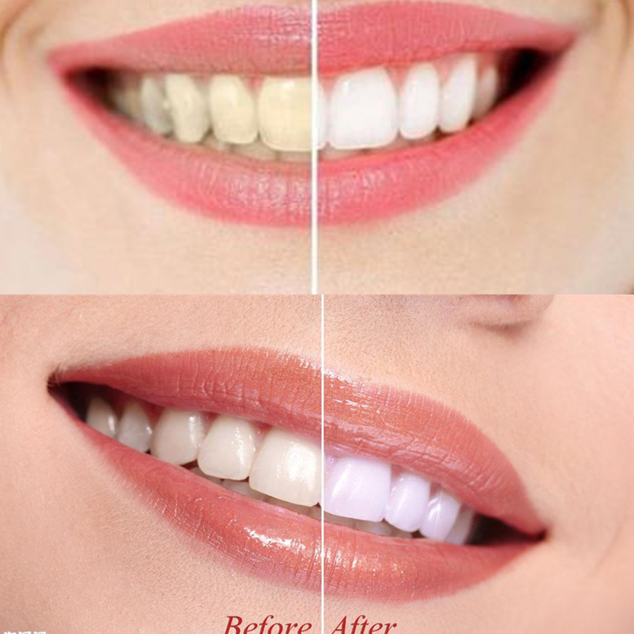 Bamboo Charcoal Teeth Tooth De - огляд і ціна Teeth Whitening Filter