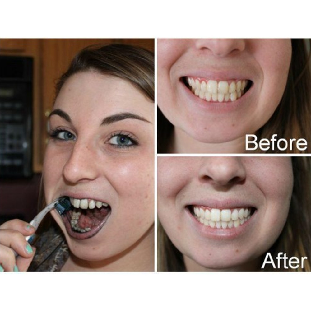 Bamboo Charcoal Teeth Tooth De - огляд і ціна Teeth Whitening Filter