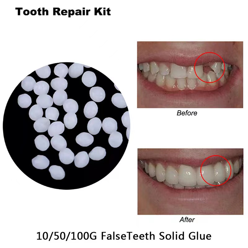 10g/bag Tooth Repair Kit-therm - огляд і ціна Teeth Whitening Uv Kit