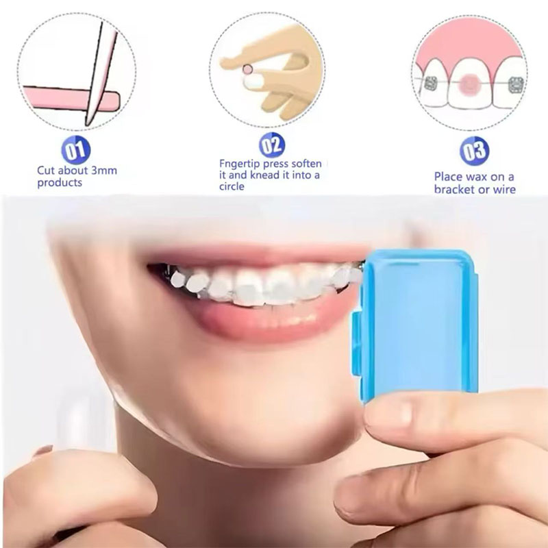 1set Orthodontic Dental Oral C - огляд і ціна Teeth Whitening With Braces