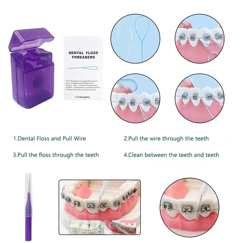 1set Orthodontic Dental Oral C - огляд і ціна Teeth Whitening With Braces