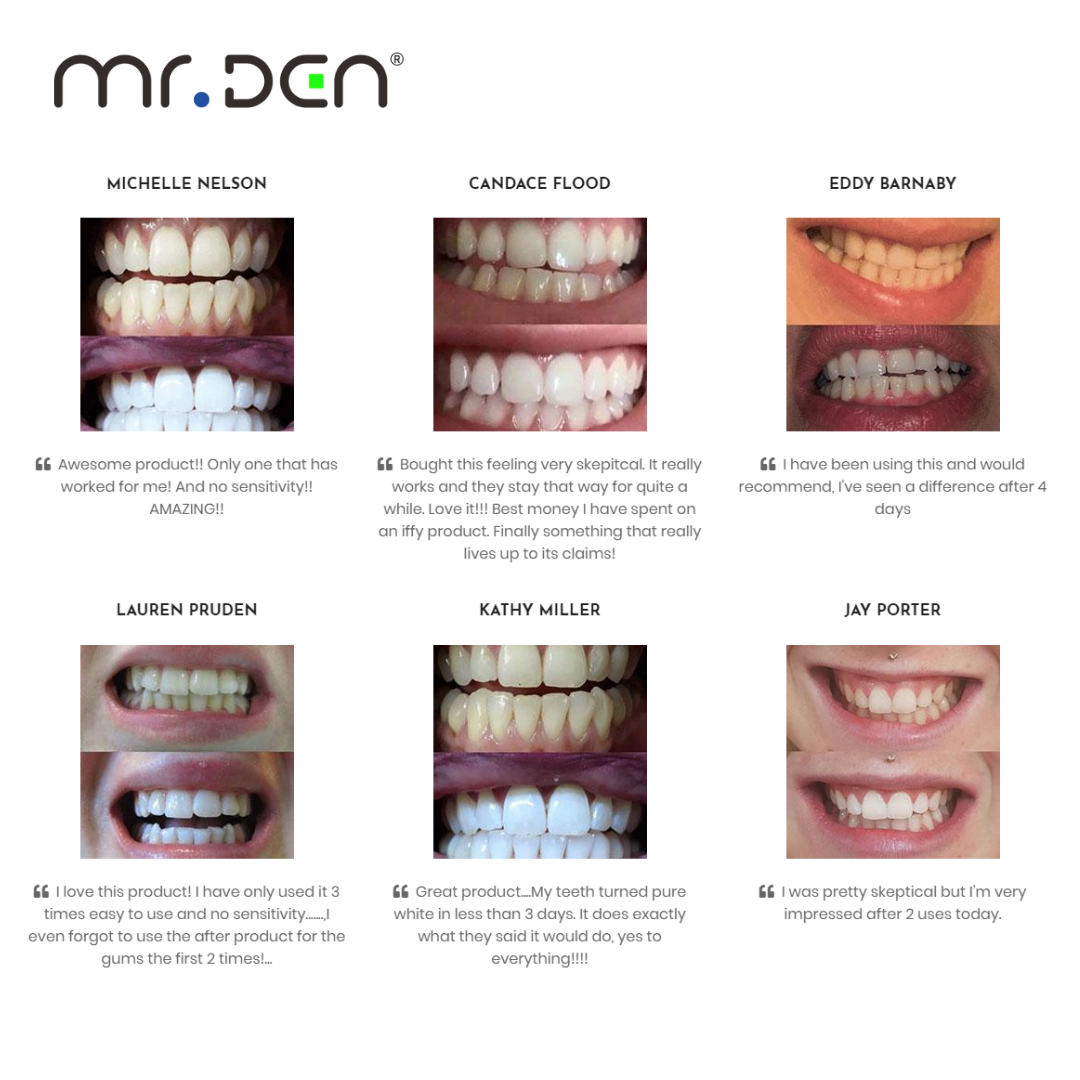 Dr. Whiten 3 Pack Teeth Whiten - огляд і ціна Teeth Whitening With Light