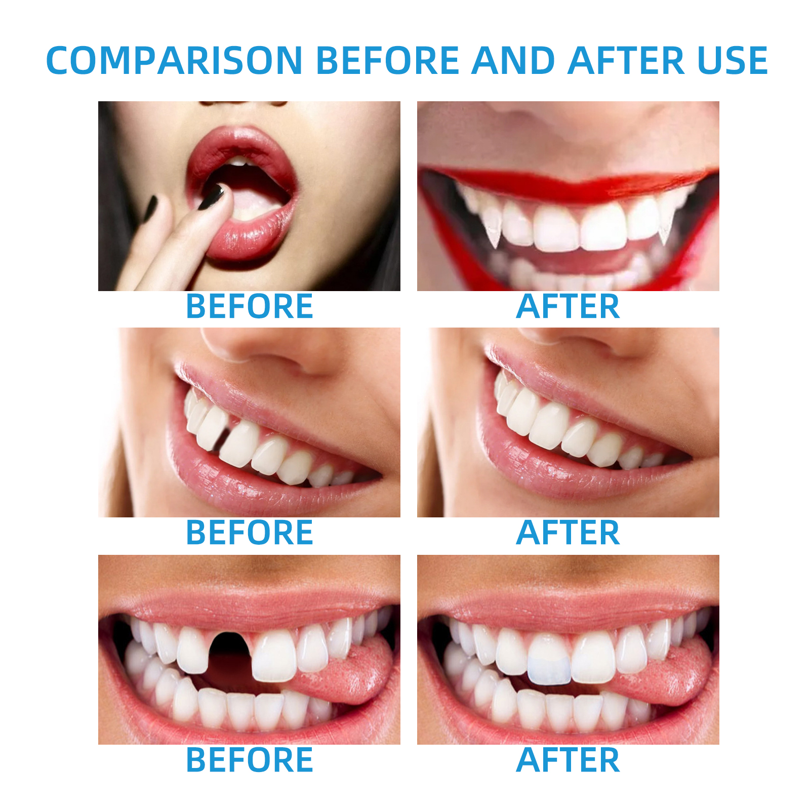 DIY Temporary Tooth Repair Kit - огляд і ціна Teeth Whitening Uv Kit