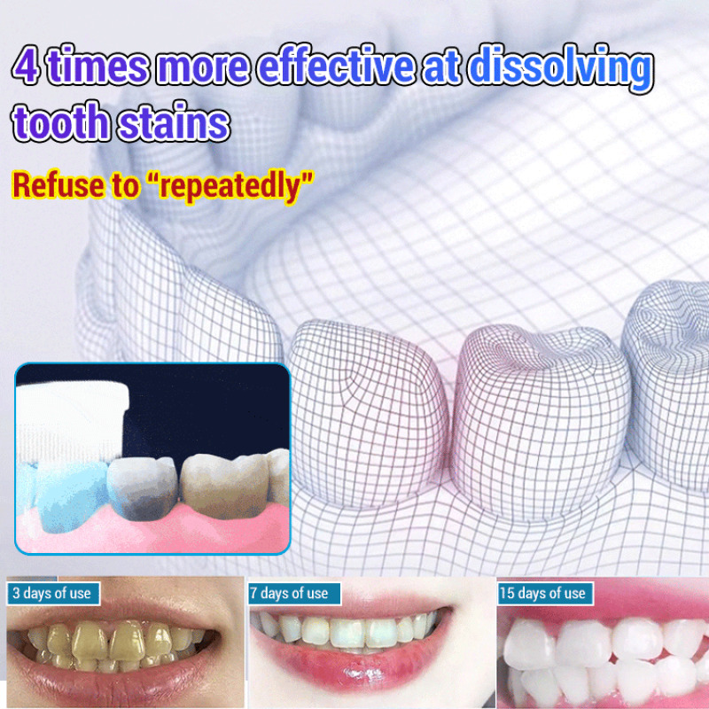 Baking Soda Whiten Teeth Fresh - огляд і ціна Teeth Whitening Baking Soda