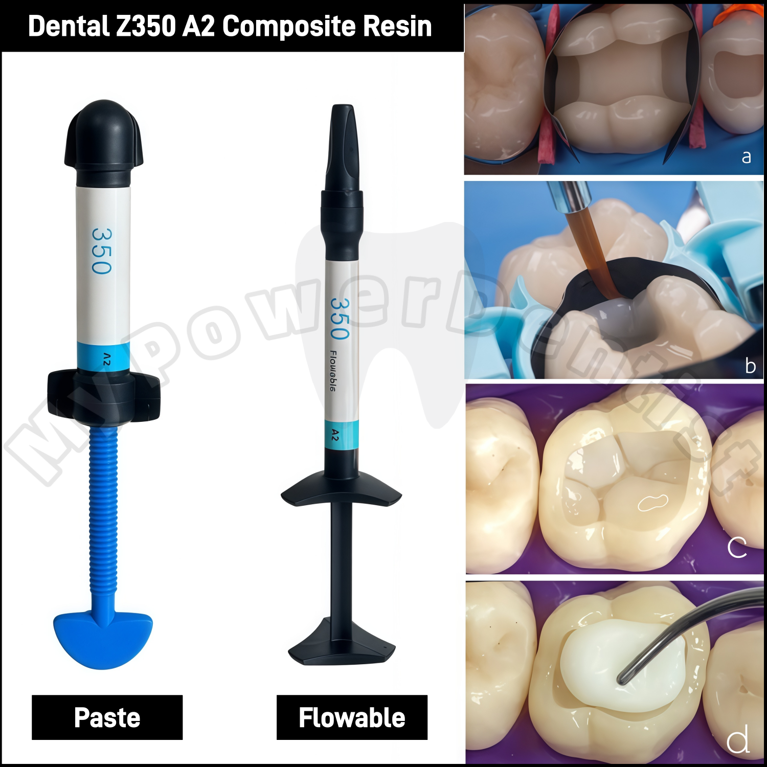 Z350 A2  Dental Composite Resi - огляд і ціна Teeth Whitening With Light