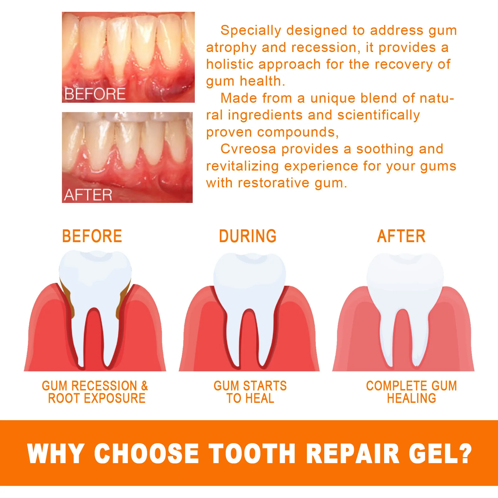 Tooth Gum Serum Repair Anti Gi - огляд і ціна Teeth Whitening Filter