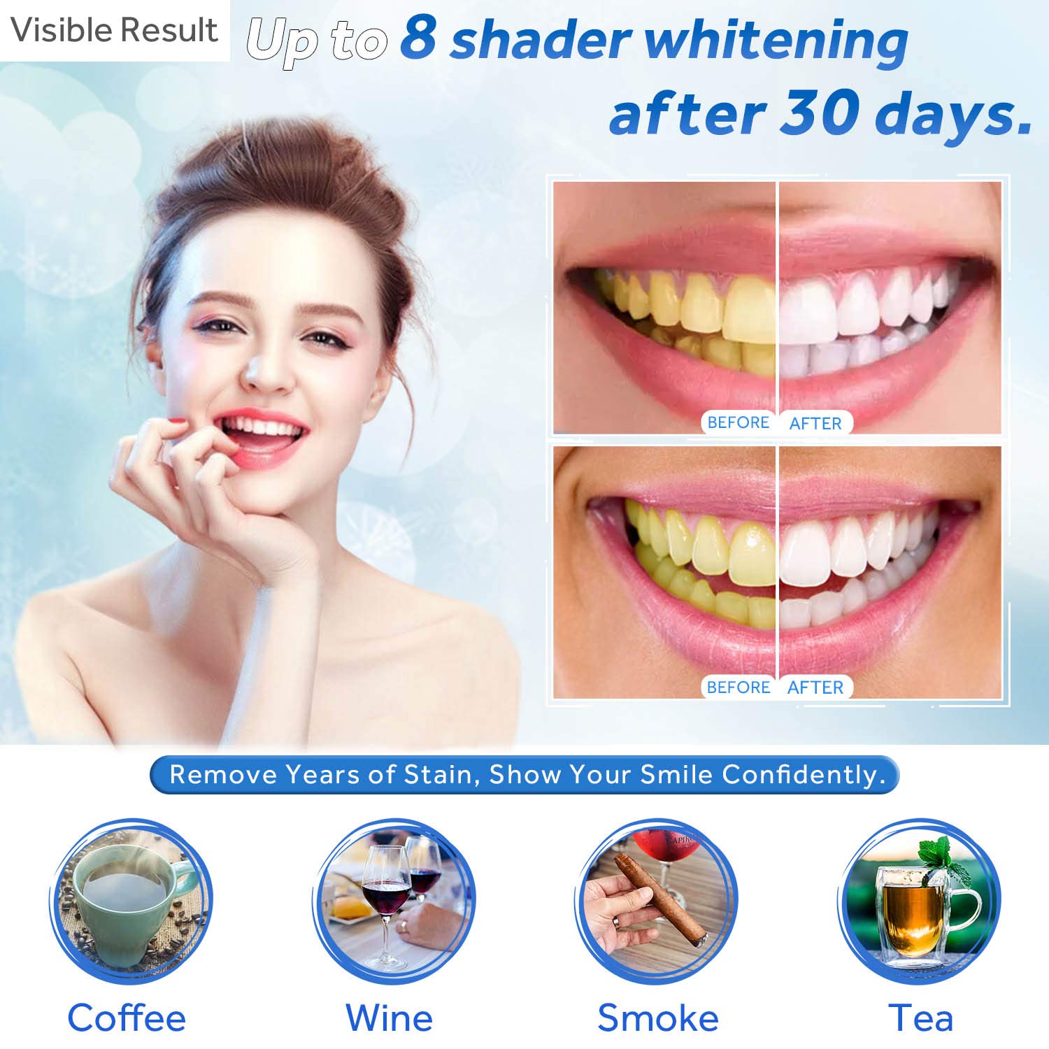 Teeth Whitening Gel Refill Syr - огляд і ціна Teeth Whitening Gel Pen