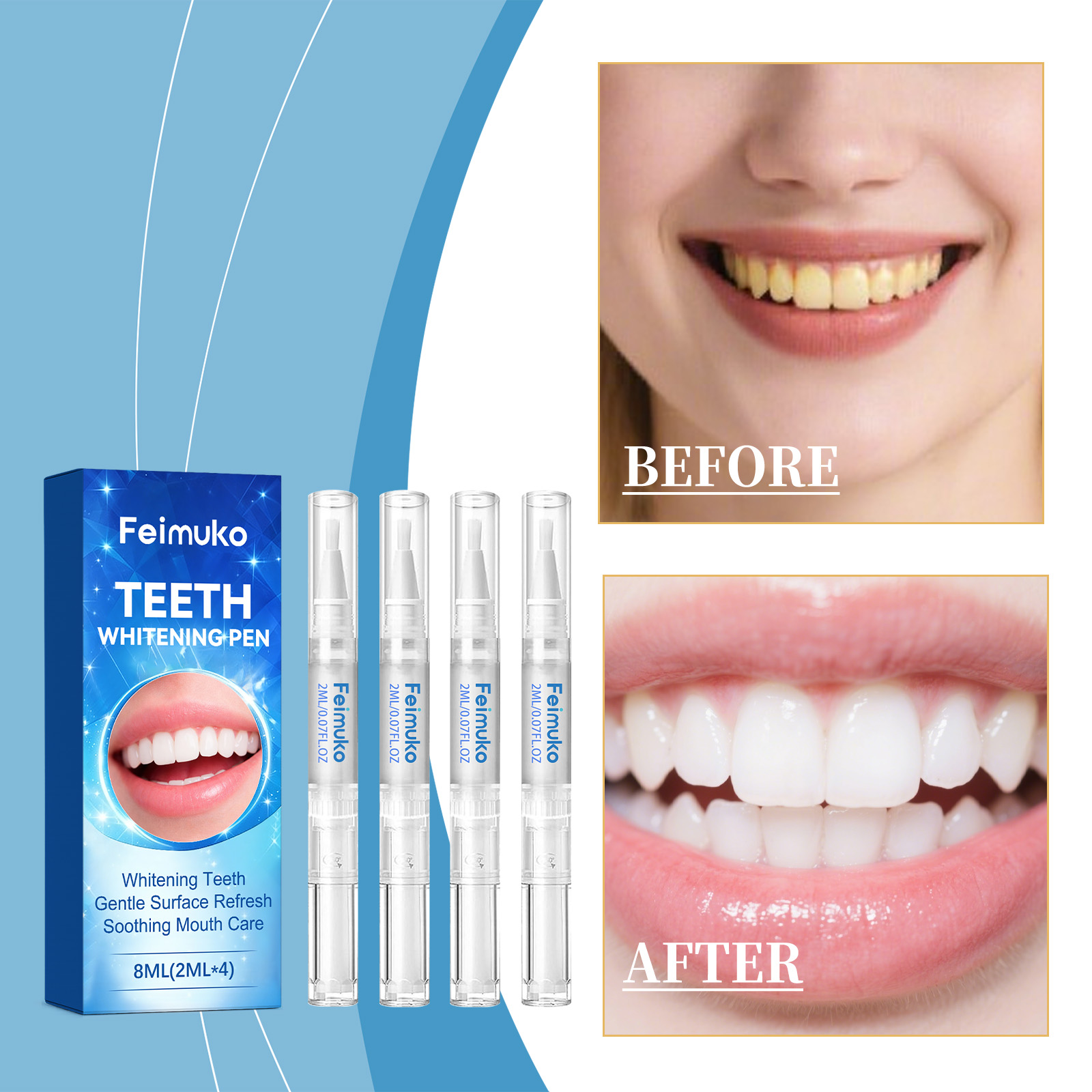 Feimuko 8ml Teeth Gel Pen Gent - огляд і ціна Teeth Whitening Gel Pen