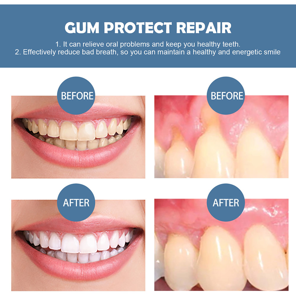 Gum Protection Repair Gel Reli - огляд і ціна Teeth Whitening Gel Pen