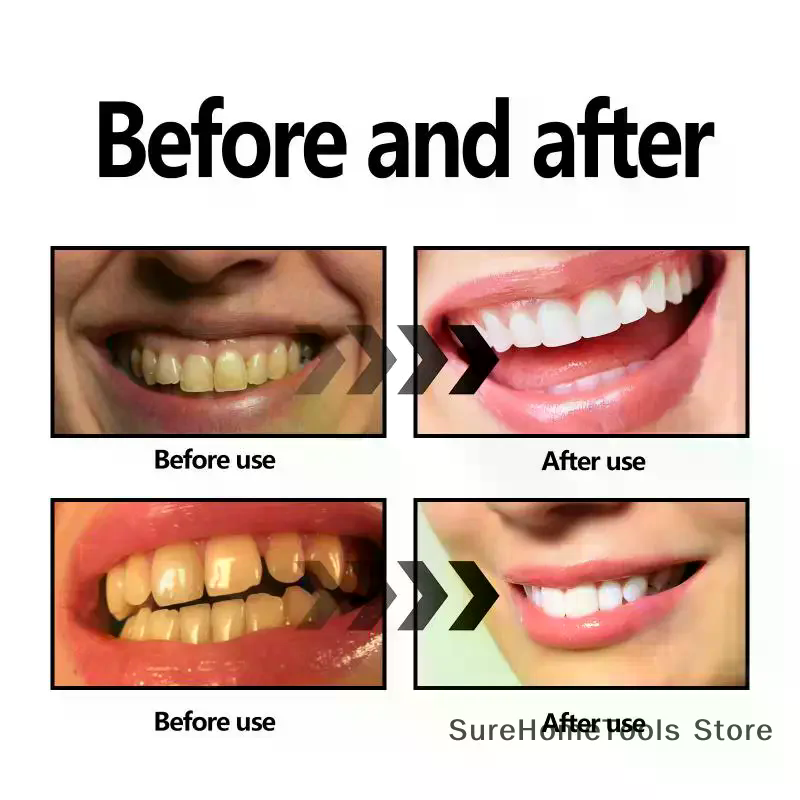 Bamboo Charcoal Powder For Tee - огляд і ціна Teeth Whitening Filter