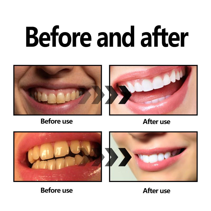 Bamboo Charcoal Powder For Tee - огляд і ціна Teeth Whitening Filter