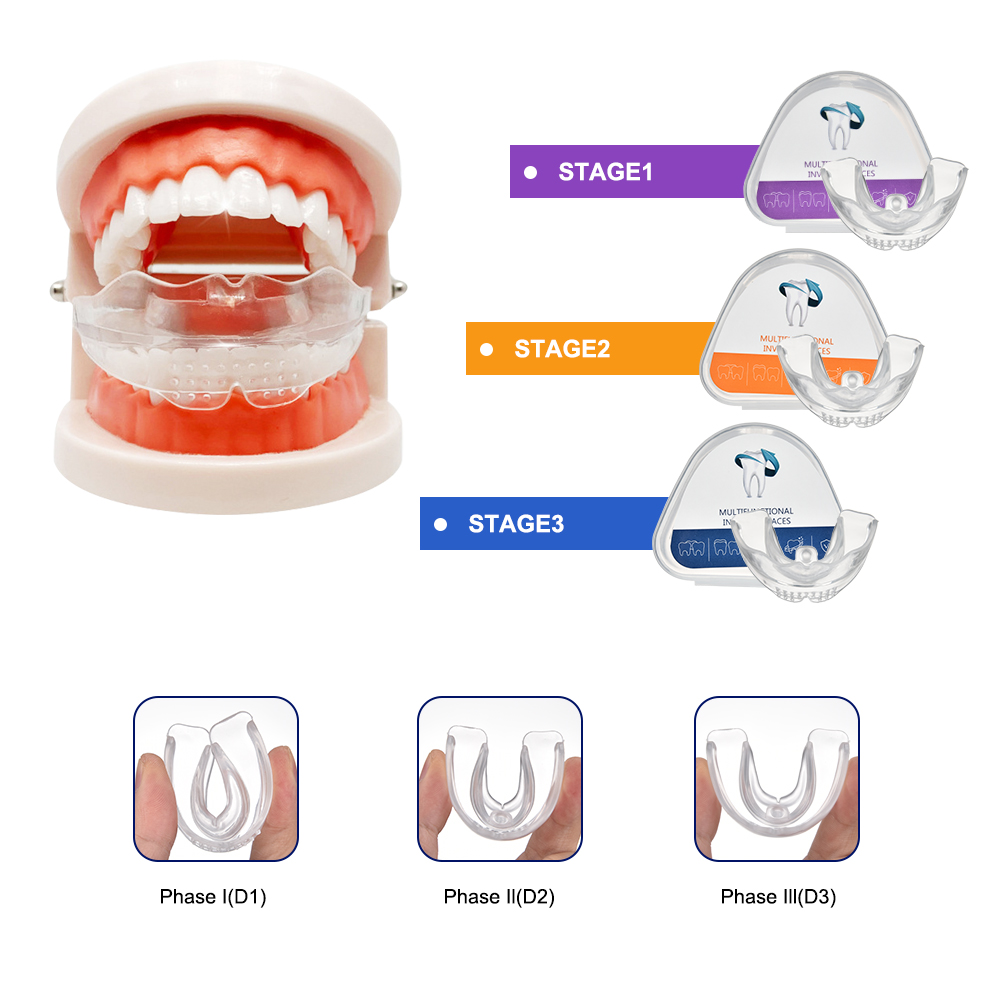 3 Stages Dental Braces Teeth T - огляд і ціна Teeth Whitening Uv Kit