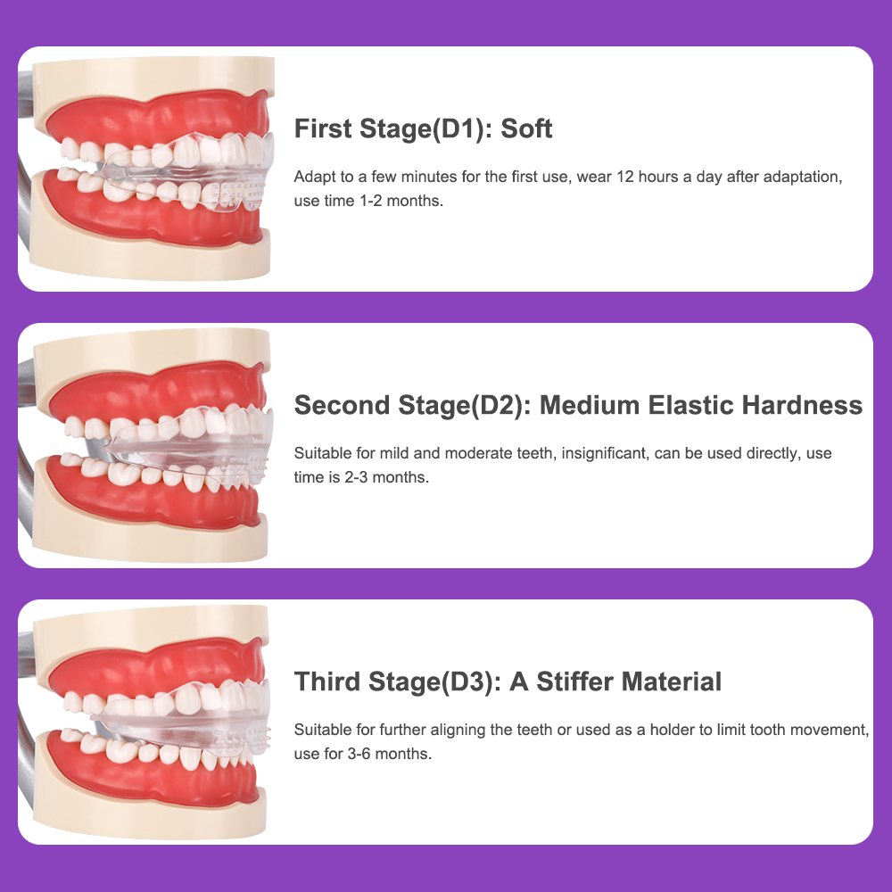 3 Stages Dental Braces Teeth T - огляд і ціна Teeth Whitening Uv Kit