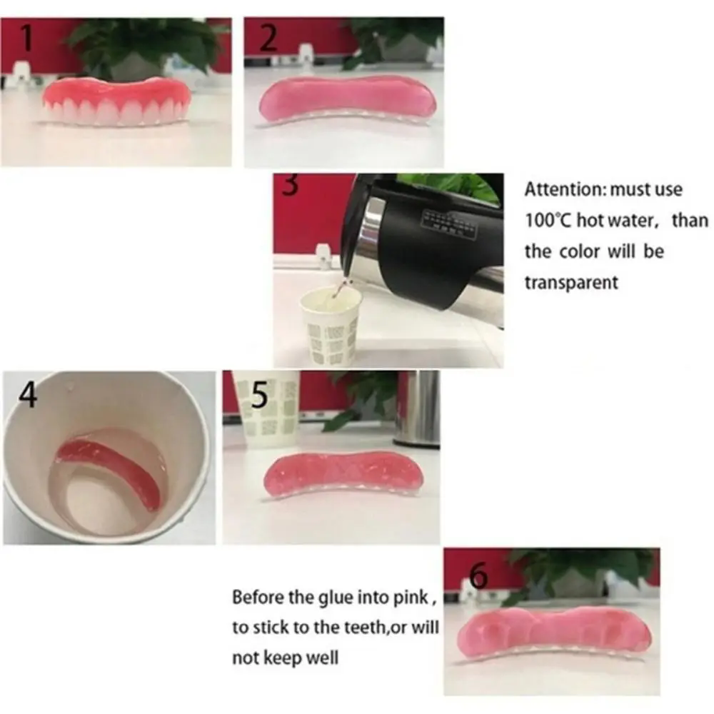 Denture Silicone Kit Silicone  - огляд і ціна Teeth Whitening Uv Kit