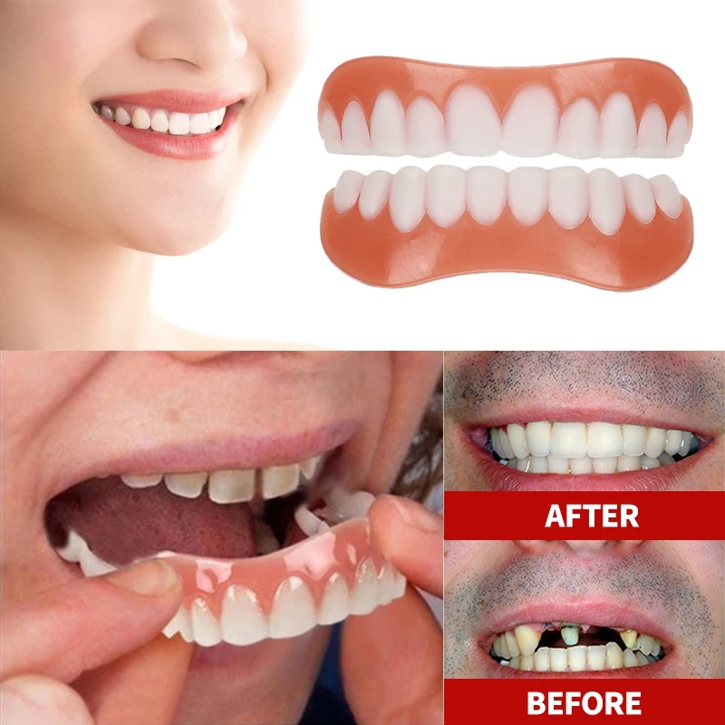 New Denture Silicone Kit Dentu - огляд і ціна Teeth Whitening With Braces