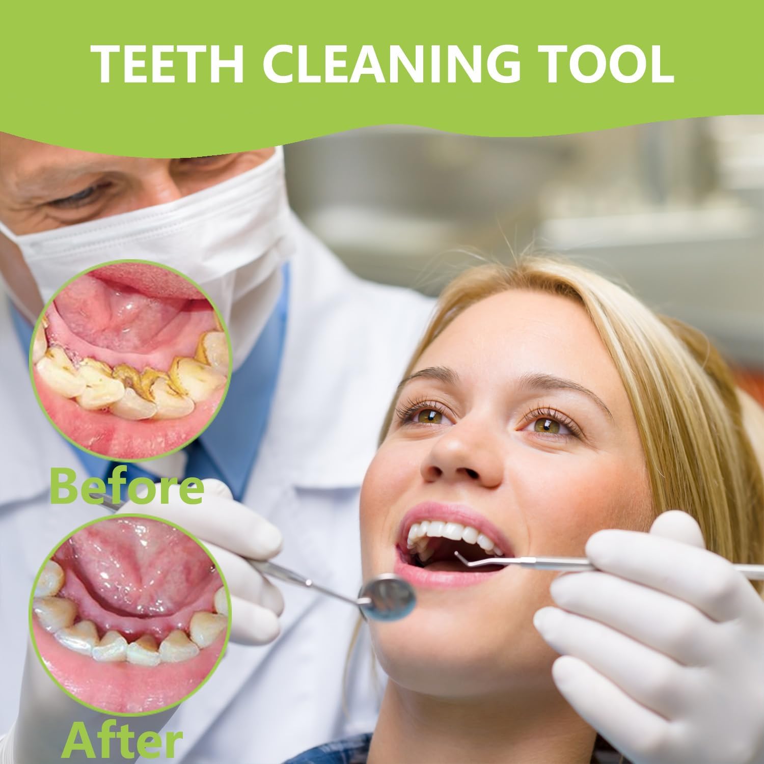 Professional Teeth Cleaning Or - огляд і ціна Teeth Whitening Machine Professional