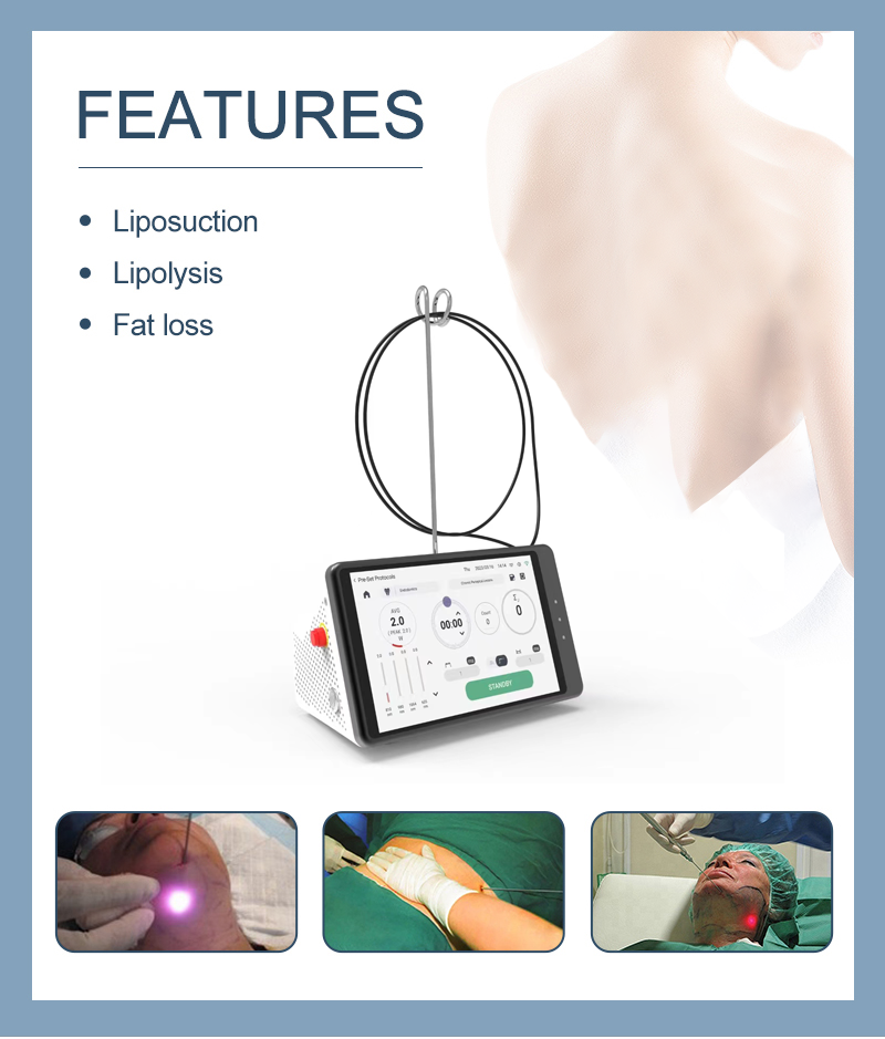 Dental Laser Teeth Whitening D - огляд і ціна Teeth Whitening With Laser