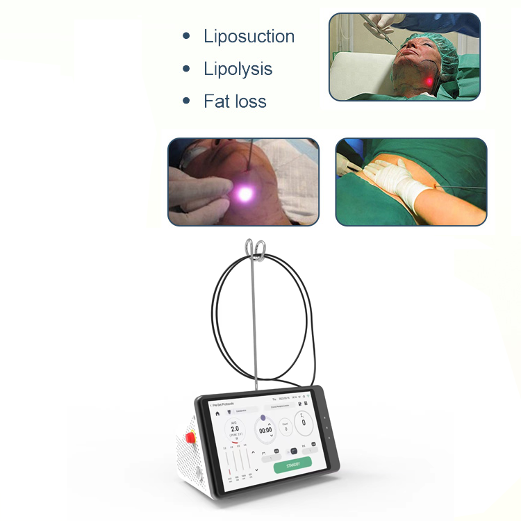 Dental Laser Teeth Whitening D - огляд і ціна Teeth Whitening With Laser
