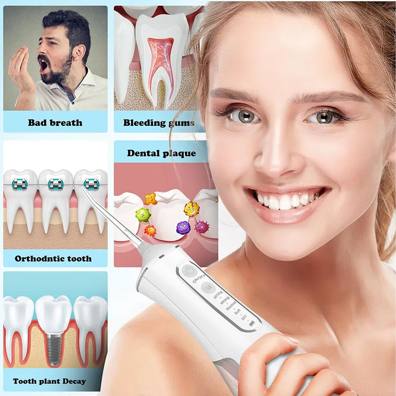 Portable Dental Water Irrigato - огляд і ціна Teeth Whitening With Laser