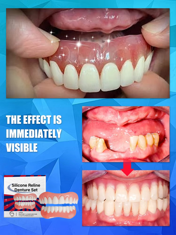 False Teeth Silicone Upper Low - огляд і ціна Teeth Whitening With Braces