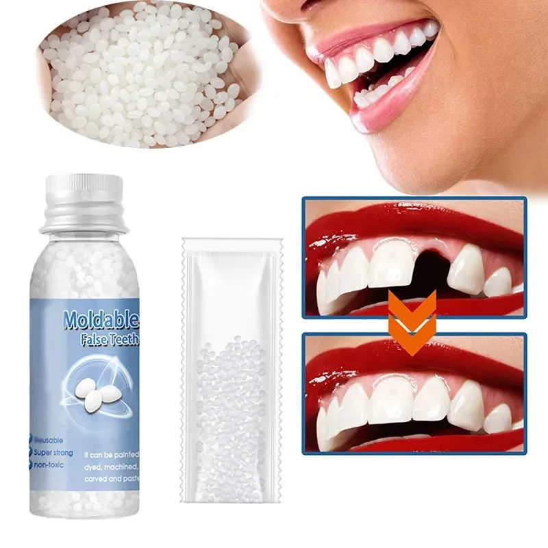 Temporary Tooth Repair Kit Tee - огляд і ціна Teeth Whitening Uv Kit