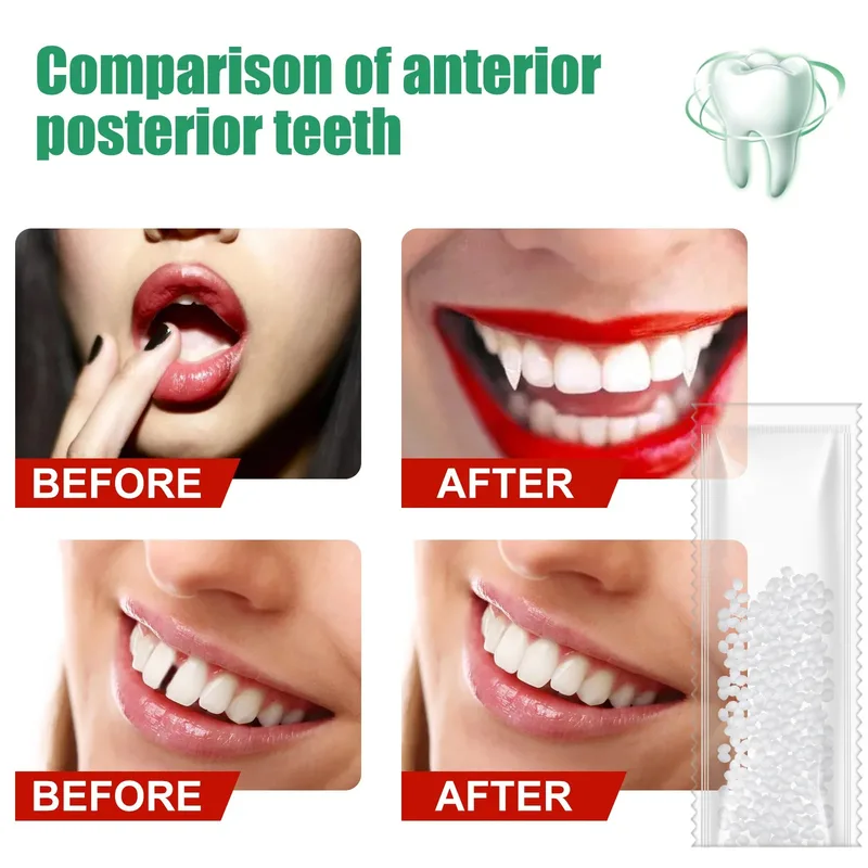 Temporary Tooth Repair Kit Tee - огляд і ціна Teeth Whitening Uv Kit