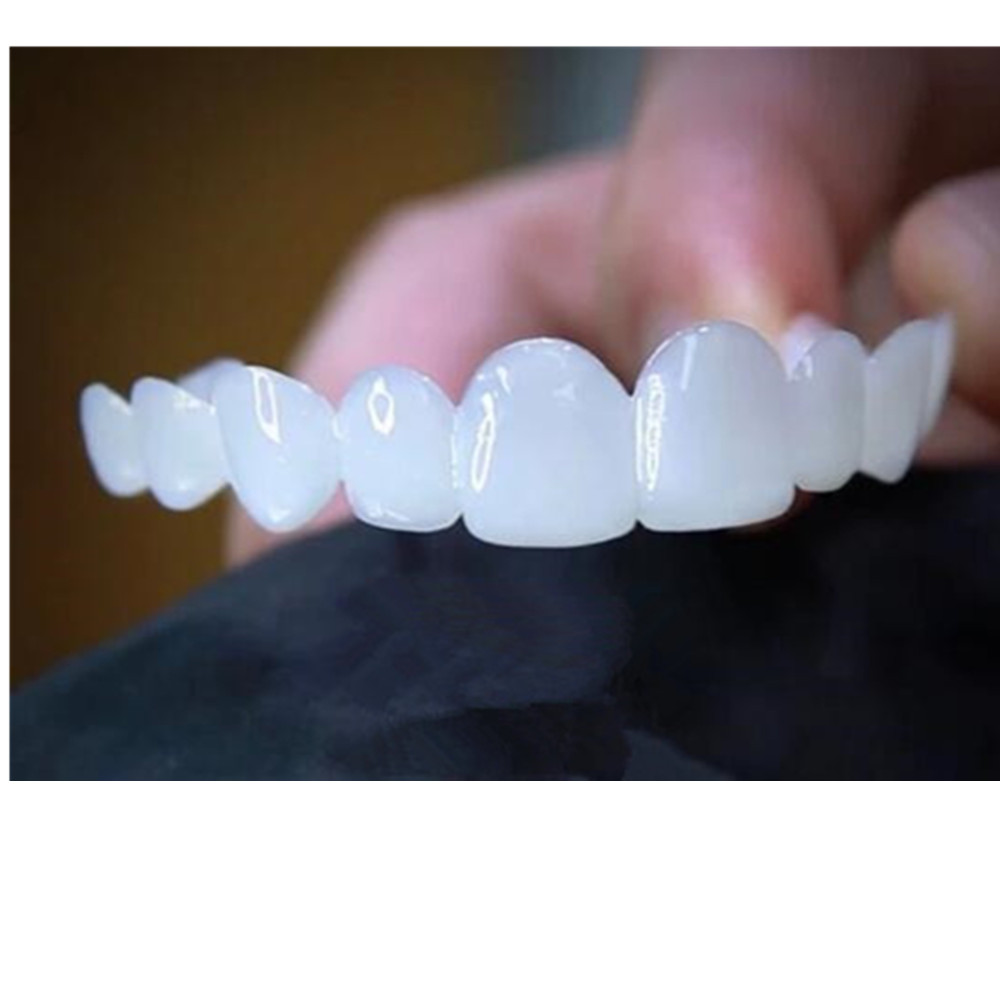 Whitening Teeth Veneers Tempor - огляд і ціна Teeth Whitening With Braces