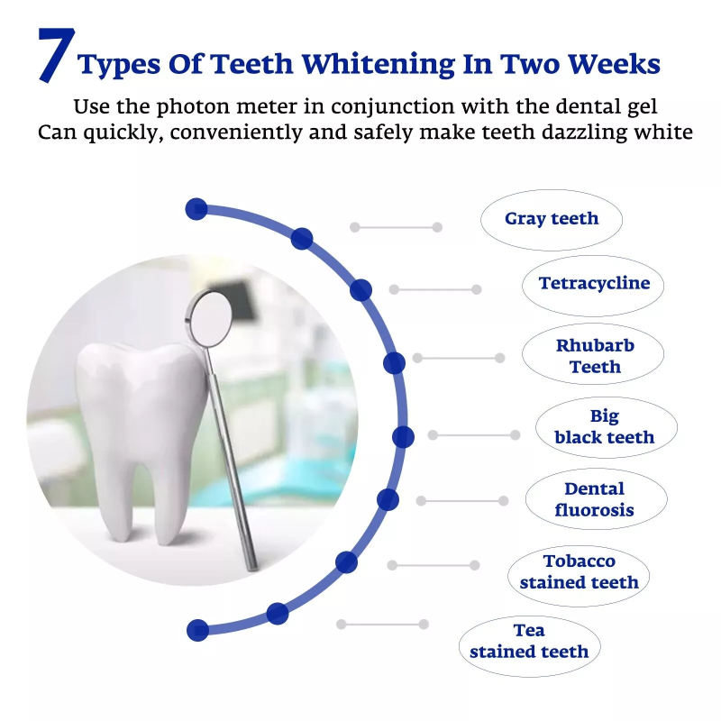 Teeth Whitening Accelerator Sm - огляд і ціна Teeth Whitening Uv Kit