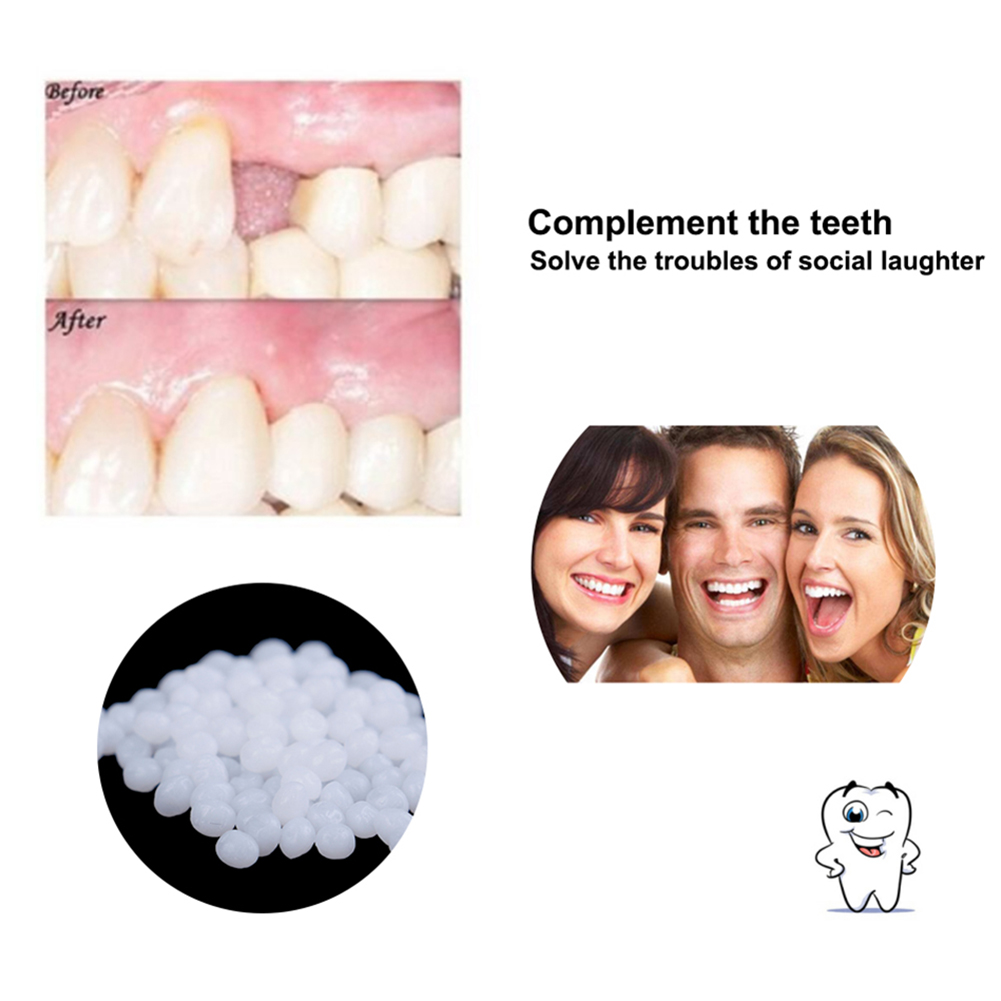 10/100g DIY Dentures Teether T - огляд і ціна Teeth Whitening Diy