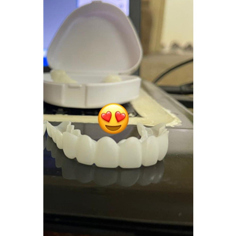 On Smile Dental Upper Lower Fa - огляд і ціна Teeth Whitening With Braces