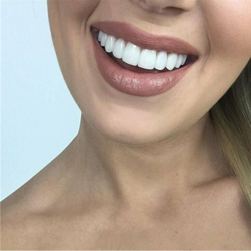 On Smile Dental Upper Lower Fa - огляд і ціна Teeth Whitening With Braces