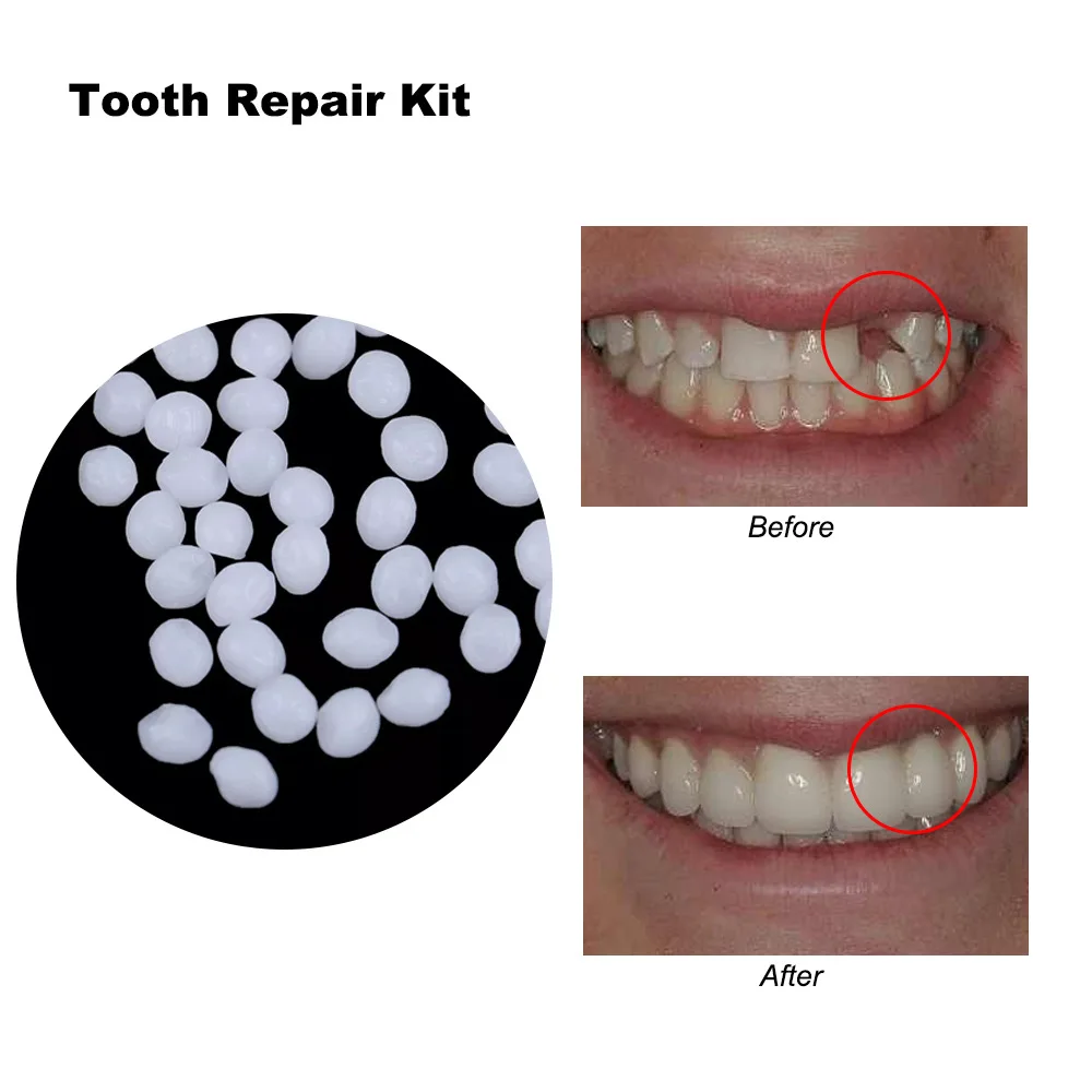 4 Colors Dental Oral False Fak - огляд і ціна Teeth Whitening Uv Kit